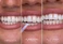 Глянець для зубів із миттєвим ефектом сяйва HiSmile Glostik Tooth Gloss - Фото 5