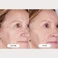 Маска для світлотерапії обличчя з LED технологією CurrentBody Skin LED Light Therapy Mask: Series 2 - Фото 6
