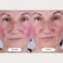 Маска для світлотерапії обличчя з LED технологією CurrentBody Skin LED Light Therapy Mask: Series 2 - Фото 7