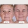 Маска для світлотерапії обличчя з LED технологією CurrentBody Skin LED Light Therapy Mask: Series 2 - Фото 5