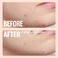 Лечебные пластыри для проблемной кожи - Peace Out Salicylic Acid Acne Healing Dots 20 Healing Dots - Фото 4