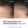Пілінг для шкіри голови The INKEY List Salicylic Acid Oily Scalp Treatment 5 oz/ 150 mL - Фото 4