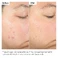Сироватка The Ordinary Salicylic Acid 2% Exfoliating Blemish Solution 30 мл - Фото 2