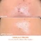 Лифтинг-маска для лица DRx SpectraLite™ FaceWare Pro - Dr. Dennis Gross Skincare - Фото 3