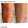 Крем Like Butter Moisturizer for Dry, Sensitive & Eczema-Prone Skin 50 мл - Фото 8