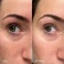 Осветляющие патчи для кожи вокруг глаз Topicals Faded Under Eye Brightening & Clearing Eye Masks, 6 пар/упаковка - Фото 5