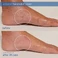 Зволожуючий крем Skinfix Eczema+ Ceramide Hand + Foot Relief Cream, 3 fl oz / 90 ml - Фото 3
