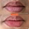 Бальзам для губ Tower 28 Beauty SOS LipSoftie™ SOS Vanilla - Clear 0.38 oz / 11 g - Фото 6